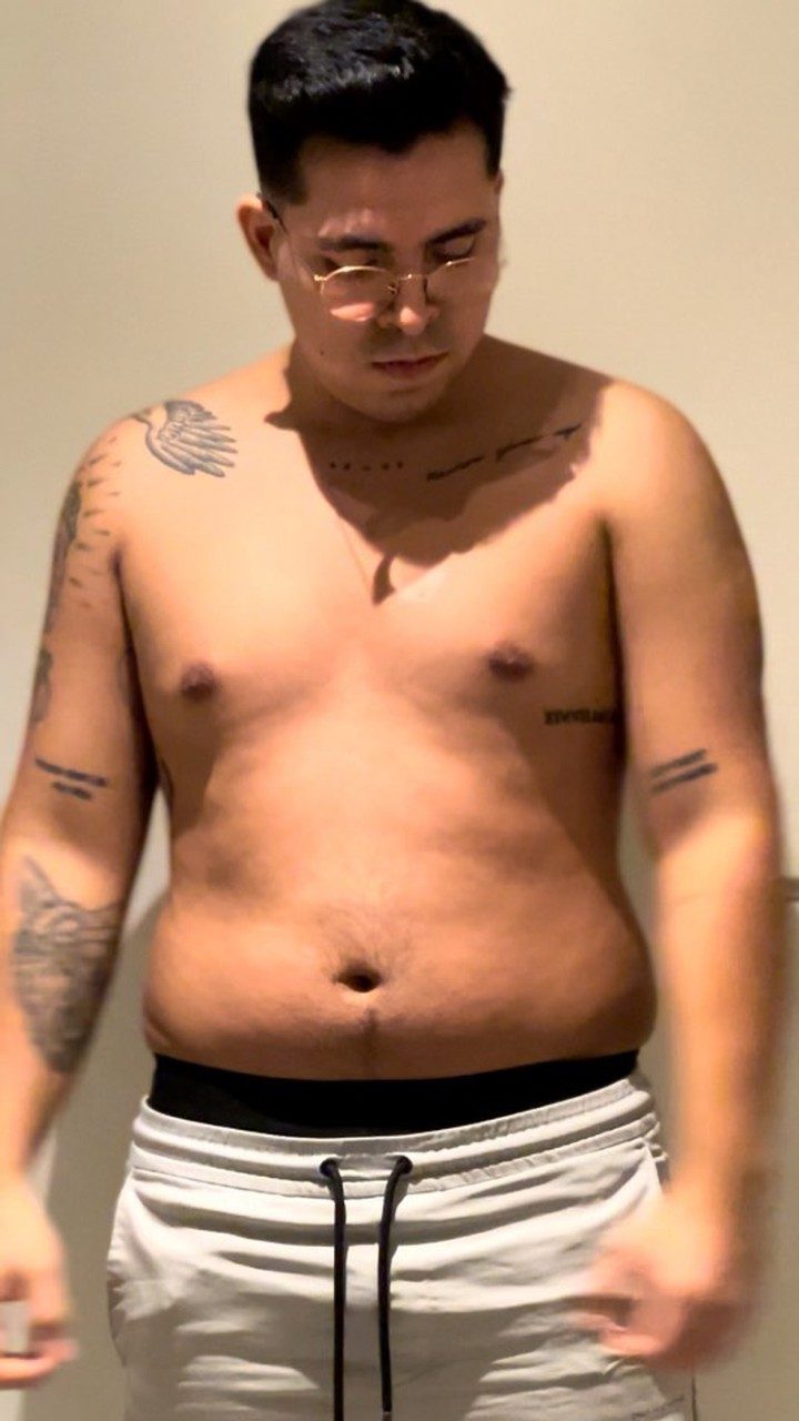 Client before